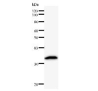 Western blot analysis of immunized recombinant protein, using anti-PSMC5 monoclonal antibody.
