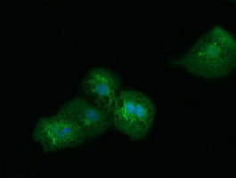 Anti-SDR9C7 mouse monoclonal antibody immunofluorescent staining of COS7 cells transiently transfected by pCMV6-ENTRY SDR9C7.