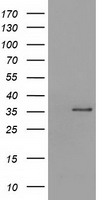 HEK293T cells were transfected with the pCMV6-ENTRY control (Left lane) or pCMV6-ENTRY SDR9C7 (Right lane) cDNA for 48 hrs and lysed. Equivalent amounts of cell lysates (5 ug per lane) were separated by SDS-PAGE and immunoblotted with anti-SDR9C7.