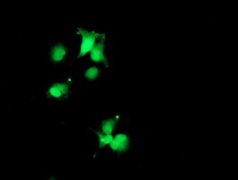 Anti-SDS mouse monoclonal antibody immunofluorescent staining of COS7 cells transiently transfected by pCMV6-ENTRY SDS.