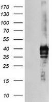 HEK293T cells were transfected with the pCMV6-ENTRY control (Left lane) or pCMV6-ENTRY SDS (Right lane) cDNA for 48 hrs and lysed. Equivalent amounts of cell lysates (5 ug per lane) were separated by SDS-PAGE and immunoblotted with anti-SDS.