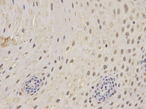 Immunohistochemistry of paraffin-embedded human esophagus using PSMC5 antibody at dilution of 1:200 (400x lens).