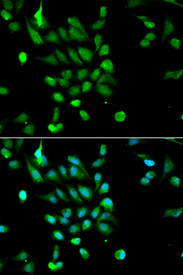 Immunofluorescence analysis of MCF7 cell using PSMC5 antibody. Blue: DAPI for nuclear staining.