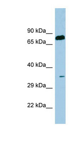SDS antibody LS-C107514 Western blot of Fetal Thymus lysate.