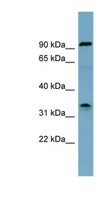 SDS antibody LS-C110646 Western blot of HT1080 cell lysate.