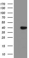 HEK293T cells were transfected with the pCMV6-ENTRY control (Left lane) or pCMV6-ENTRY SDS (Right lane) cDNA for 48 hrs and lysed. Equivalent amounts of cell lysates (5 ug per lane) were separated by SDS-PAGE and immunoblotted with anti-SDS.