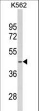 Western blot of SDS Antibody in K562 cell line lysates (35 ug/lane). SDS (arrow) was detected using the purified antibody.