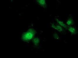 Anti-SDS mouse monoclonal antibody immunofluorescent staining of COS7 cells transiently transfected by pCMV6-ENTRY SDS.