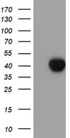 HEK293T cells were transfected with the pCMV6-ENTRY control (Left lane) or pCMV6-ENTRY SDS (Right lane) cDNA for 48 hrs and lysed. Equivalent amounts of cell lysates (5 ug per lane) were separated by SDS-PAGE and immunoblotted with anti-SDS.