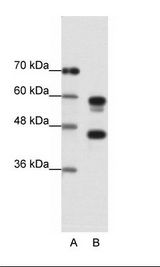 A: Marker, B: Jurkat Cell Lysate