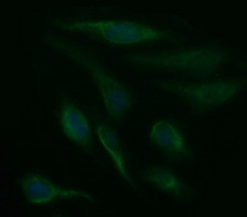Immunofluorescent staining of HeLa cells using anti-SDSL mouse monoclonal antibody.