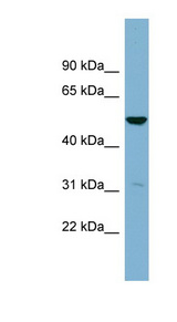 SDSL antibody LS-C111061 Western blot of NCI-H226 cell lysate.