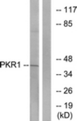Western blot of extracts from COLO205 cells, using PKR1 Antibody. The lane on the right is treated with the synthesized peptide.