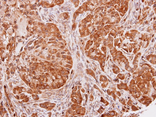 IHC of paraffin-embedded A549 xenograft using SEC13L1 antibody at 1:100 dilution.
