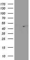 HEK293T cells were transfected with the pCMV6-ENTRY control (Left lane) or pCMV6-ENTRY SEC14L2 (Right lane) cDNA for 48 hrs and lysed. Equivalent amounts of cell lysates (5 ug per lane) were separated by SDS-PAGE and immunoblotted with anti-SEC14L2.