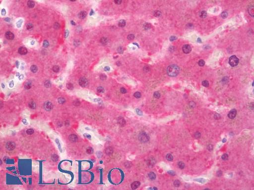 Human Liver: Formalin-Fixed, Paraffin-Embedded (FFPE)