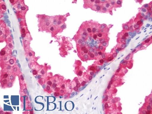 Human Prostate: Formalin-Fixed, Paraffin-Embedded (FFPE)