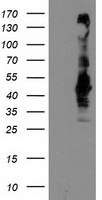 HEK293T cells were transfected with the pCMV6-ENTRY control (Left lane) or pCMV6-ENTRY SEC14L2 (Right lane) cDNA for 48 hrs and lysed. Equivalent amounts of cell lysates (5 ug per lane) were separated by SDS-PAGE and immunoblotted with anti-SEC14L2.