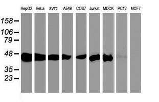 Western blot of extracts (35 ug) from 9 different cell lines by using anti-SEC14L2 monoclonal antibody.