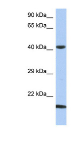SEC14L4 antibody LS-C111692 Western blot of OVCAR-3 cell lysate.
