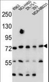 SEC14L5 Antibody western blot of K562,NCI-H460,ZR-75-1,293,MDA-MB231 cell line lysates (35 ug/lane). The SEC14L5 antibody detected the SEC14L5 protein (arrow).