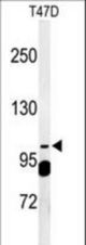 Western blot of SC24A Antibody in T47D cell line lysates (35 ug/lane). SC24A (arrow) was detected using the purified antibody.