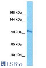 SEC24C antibody Western Blot of MCF7. Antibody dilution: 1 ug/ml.