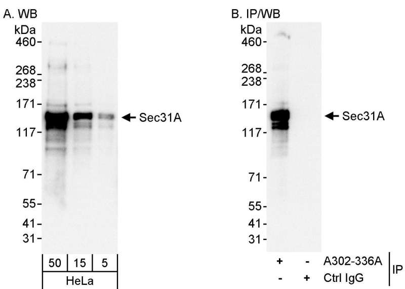 Detection of Human Sec31A by Western Blot and Immunoprecipitation. Samples: Whole cell lysate (5, 15 and 50 ug for WB; 1 mg for IP, 20% of IP loaded) from HeLa cells. Antibody: Affinity purified rabbit anti-Sec31A antibody used for WB at 0.04 ug/ml (A) and 0.1 ug/ml (B) and used for IP at 3 ug/mg lysate. Detection: Chemiluminescence with exposure times of 3 seconds (A and B).