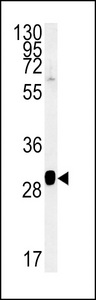 SC31B Antibody western blot of NCI-H460 cell line lysates (15 ug/lane). The SC31B antibody detected the SC31B protein (arrow).
