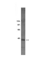 WB: Rat brain microsomal preparation was probed with Anti-Sec61