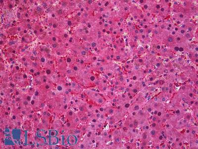 Anti-SEC61A1 / SEC61 antibody IHC of human liver. Immunohistochemistry of formalin-fixed, paraffin-embedded tissue after heat-induced antigen retrieval. Antibody LS-B5905 concentration 3.75 ug/ml.
