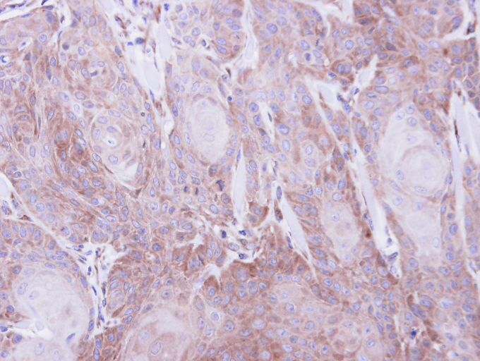 IHC of paraffin-embedded Cal27 xenograft using SEC61A1 antibody at 1:500 dilution.