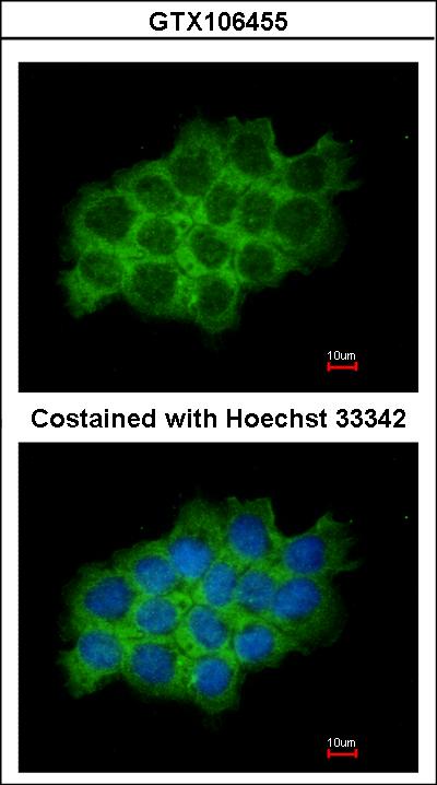 Immunofluorescence of methanol-fixed A431 using SEC61A1 antibody at 1:200 dilution.