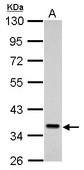 Sample (30 ug of whole cell lysate). A: K562. 10% SDS PAGE. SEC61 antibody diluted at 1:1000.