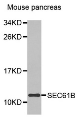 Western blot analysis of extracts of Mouse pancreas cell lines, using SEC61B antibody.