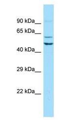 SEC62 / TP-1 antibody Western Blot of NCI-H226.