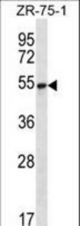 SEC62 Antibody western blot of ZR-75-1 cell line lysates (35 ug/lane). The SEC62 antibody detected the SEC62 protein (arrow).