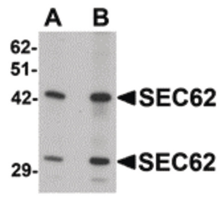 Western blot of SEC62 in rat brain tissue lysate with SEC62 antibody at (A) 0.5 and (B) 1 ug/ml.