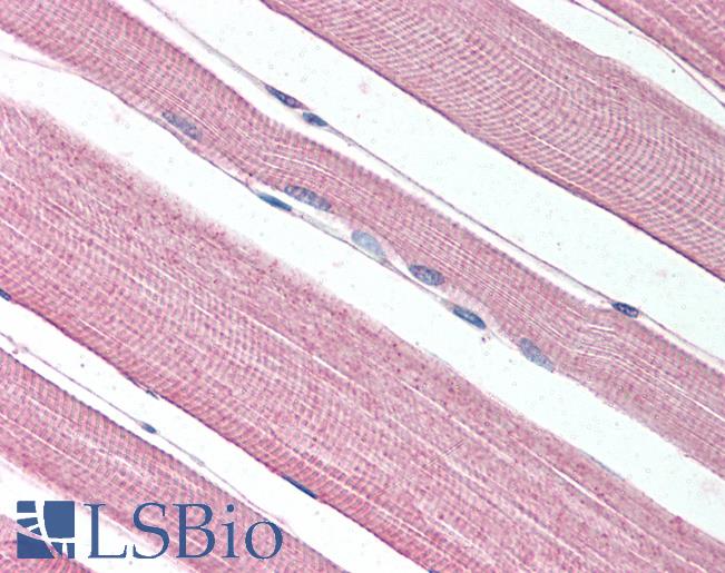 Anti-PROKR1 antibody LS-A6684 IHC of human skeletal muscle. Immunohistochemistry of formalin-fixed, paraffin-embedded tissue after heat-induced antigen retrieval.