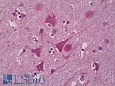 Anti-EPHX2 antibody IHC of human brain, cortex neurons. Immunohistochemistry of formalin-fixed, paraffin-embedded tissue after heat-induced antigen retrieval. Antibody LS-B6940 concentration 5 ug/ml.
