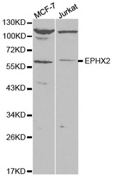 Western blot analysis of extracts of various cell lines, using EPXH2 antibody.
