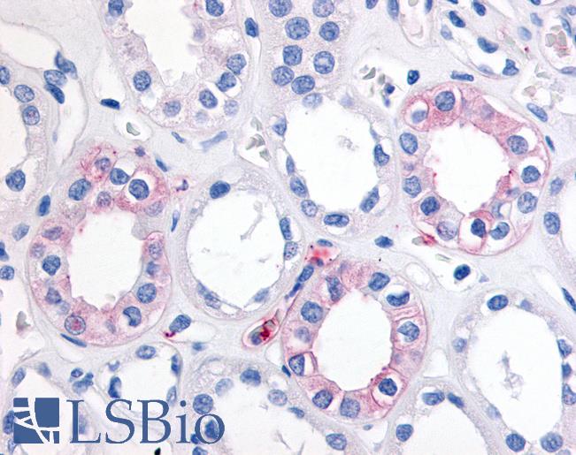 Anti-EPHX2 antibody LS-A8989 IHC of human kidney. Immunohistochemistry of formalin-fixed, paraffin-embedded tissue after heat-induced antigen retrieval.