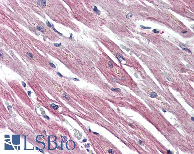 Anti-EPHX2 antibody LS-A8996 IHC of human heart. Immunohistochemistry of formalin-fixed, paraffin-embedded tissue after heat-induced antigen retrieval.