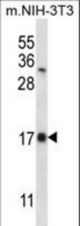 SELK Antibody western blot of mouse NIH-3T3 cell line lysates (35 ug/lane). The SELK antibody detected the SELK protein (arrow).