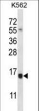 SELK Antibody western blot of K562 cell line lysates (35 ug/lane). The SELK antibody detected the SELK protein (arrow).