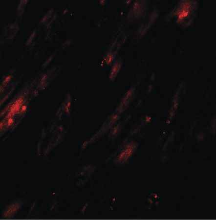 Immunofluorescence of SELK in human heart tissue with SELK antibody at 20 ug/ml.