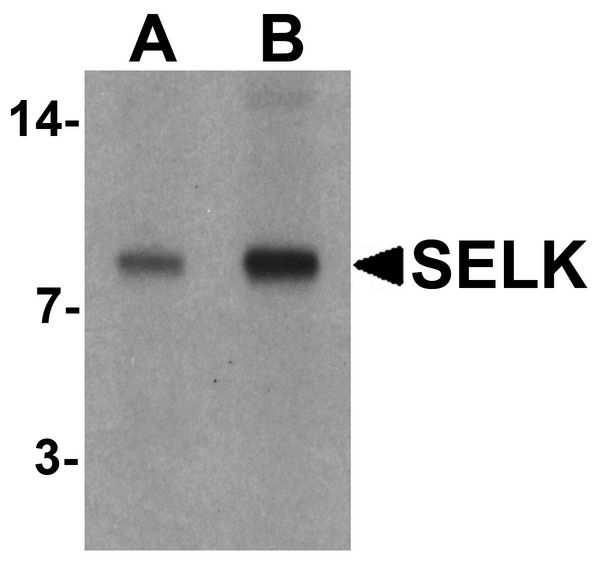 Western blot analysis of SELK in A20 cell lysate with SELK antibody at (A) 1 and (B) 2 ug/ml.