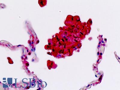 Anti-SELL / L-Selectin / CD62L antibody IHC staining of human lung, macrophages. Immunohistochemistry of formalin-fixed, paraffin-embedded tissue after heat-induced antigen retrieval.