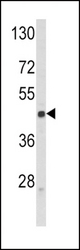 Western blot of SELL Antibody in Jurkat cell line lysates (35 ug/lane). SELL (arrow) was detected using the purified antibody.