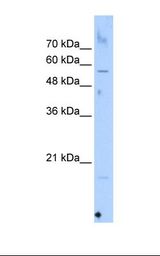 HepG2 cell lysate. Antibody concentration: 1.0 ug/ml. Gel concentration: 12%.